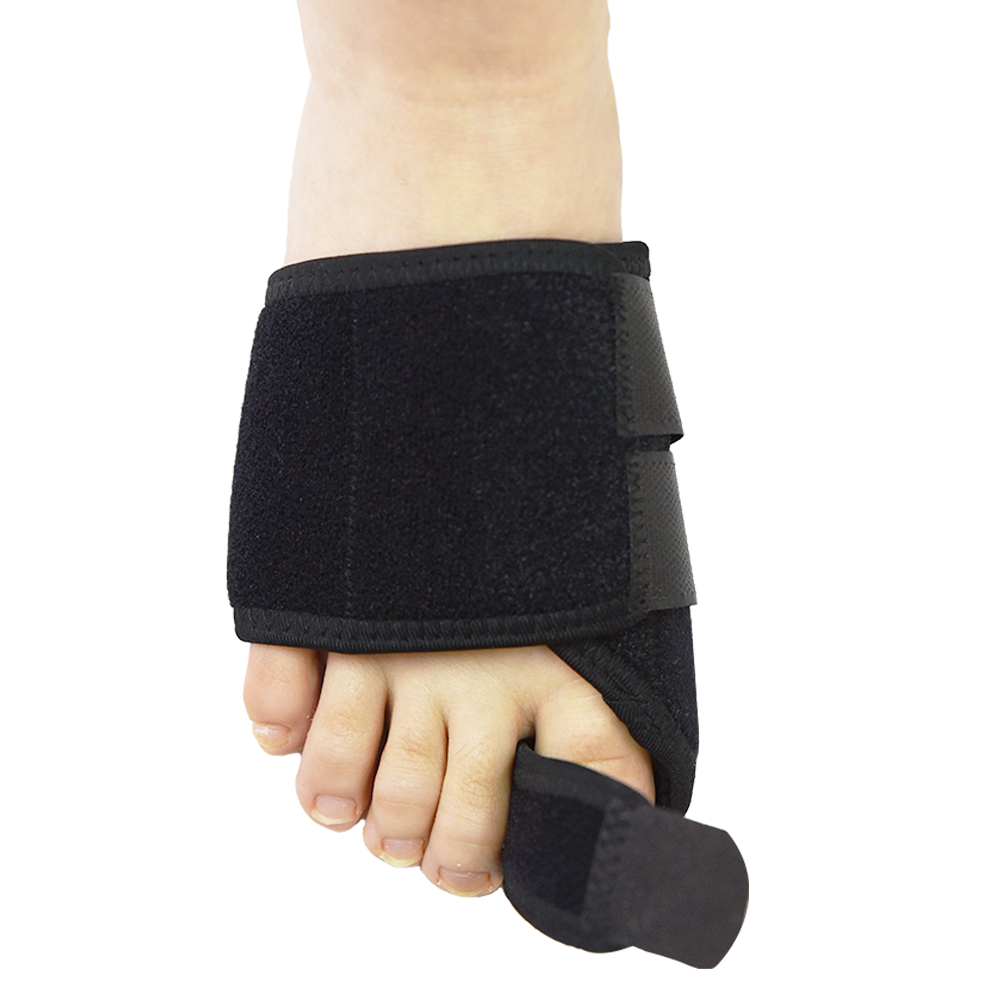 hallux valgus gs60606.jpg