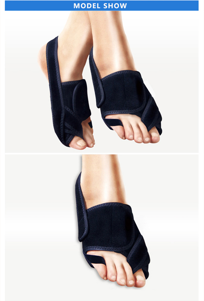 hallux valgus gs60608.jpg