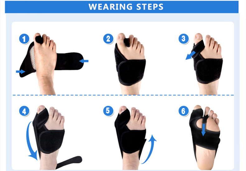 hallux valgus gs60607.jpg